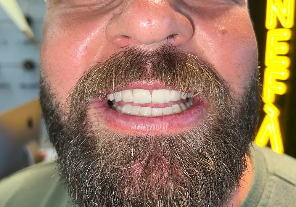 Dental Lamina - Voila Health