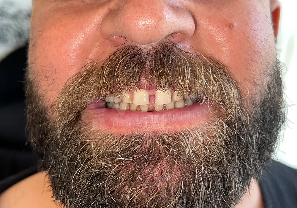 Dental Lamina - Voila Health